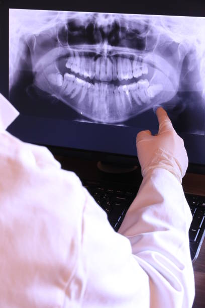 Best Emergency Treatment for Dental Infections or Abscesses in Xtang, PA